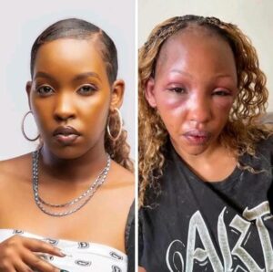 Weasel Manizo Beats Baby Mama Teta, Leaves Her In Excruciating Pain