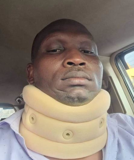 Nobert Events Accuses Alien Skin Of Breaking His Neck