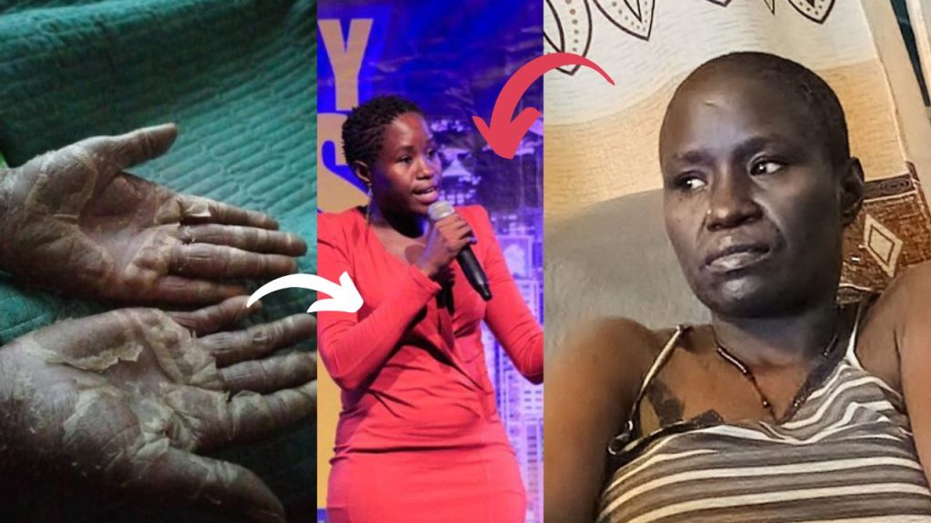 Comedienne Akite Agnes Shares Ordeal Amid Health Struggles