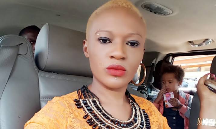 Don Zella Addresses Online Bullying Over Skin Bleaching